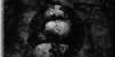 Wojczech - Sedimente